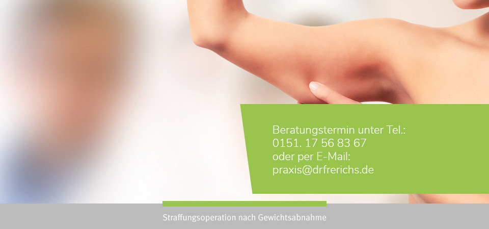 header Straffungsoperation nach Gewichtsabnahme